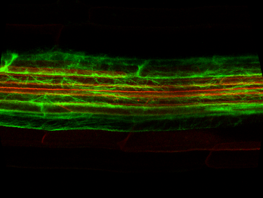 Fluorescence microscopy